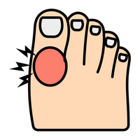 Pain in the arch or heel